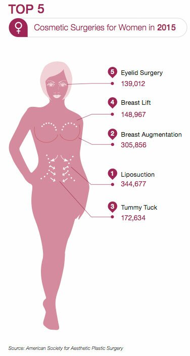 Top 5 Procedures for Women
